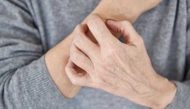 این نشانه‌ها یعنی بیماری پوستی